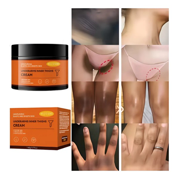 Adecuado Para Manchas, Cloasma Y Acné. Crema Antipecas.