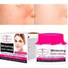 Aichun Crema Facial Aclaradora Remueve Manchas Oscura