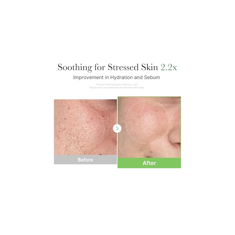 medicube Exosome Cica Tea Tree Cream | For Sensitive Skin