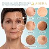 Abera Melasma Srum, Suero Facial Despigmentante, Tratamiento para Melasma y