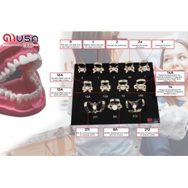 MUSAMED Set of 12 Endodontic Rubber Dam Clamp #0#1#2#2a #7#12a #13a #14#14a #8a #211#212 Mirror Finish with Black Plastic Tray Premium Grade Stainless Steel Restorative Dental Instruments Tools