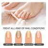 I Nail Repair Essence Repara La - Tt I