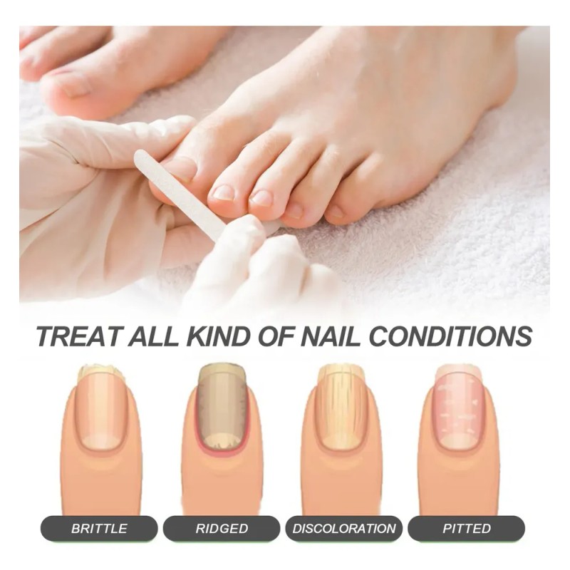 I Nail Repair Essence Repara La - Tt I