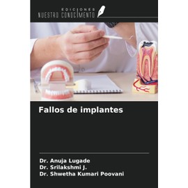 Fallos de implantes