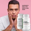 Probiotic Pro Keraderm - Probiotic Immune Support – Targeted Nail