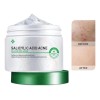 Gel Facial Ácido Salicílico Universo en Linea Antiacné Noche 120ml