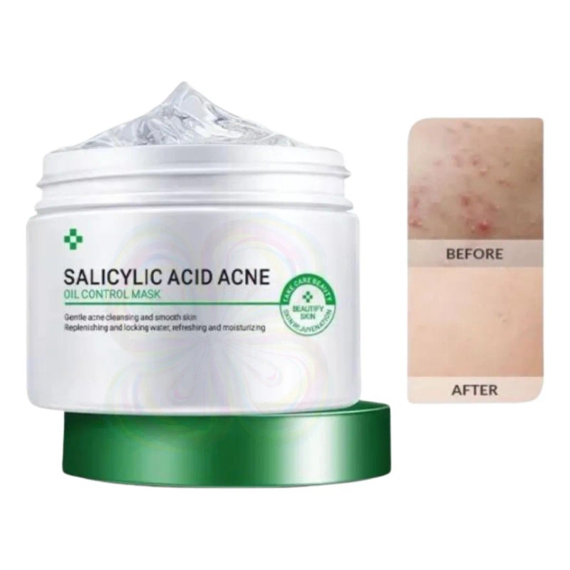 Gel Facial Ácido Salicílico Universo en Linea Antiacné Noche 120ml