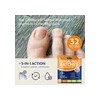 Tratamiento De Hongos En Las Uñas De Los Pies Vigorwell