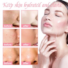 Dyceittdia 75 ml Niacinamide Serum and 50 ml Watermelon Essence Face Cream, Watermelon Essence Set, Moisturising Skin, Cream4