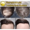 Immediately Thick Hair XXL Premium Hair Thickening Scattered Hair Trading