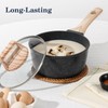 SODAY 12 Pcs Pots and Pans Set Non Stick, Cookware