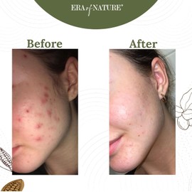 era of nature era of nature Best Raw ORGANIC AFRICAN BLACK SOAP, for Dry Skin and Skin Conditions. Pure & Natural Ingredients, Imported From Ghana - 8oz