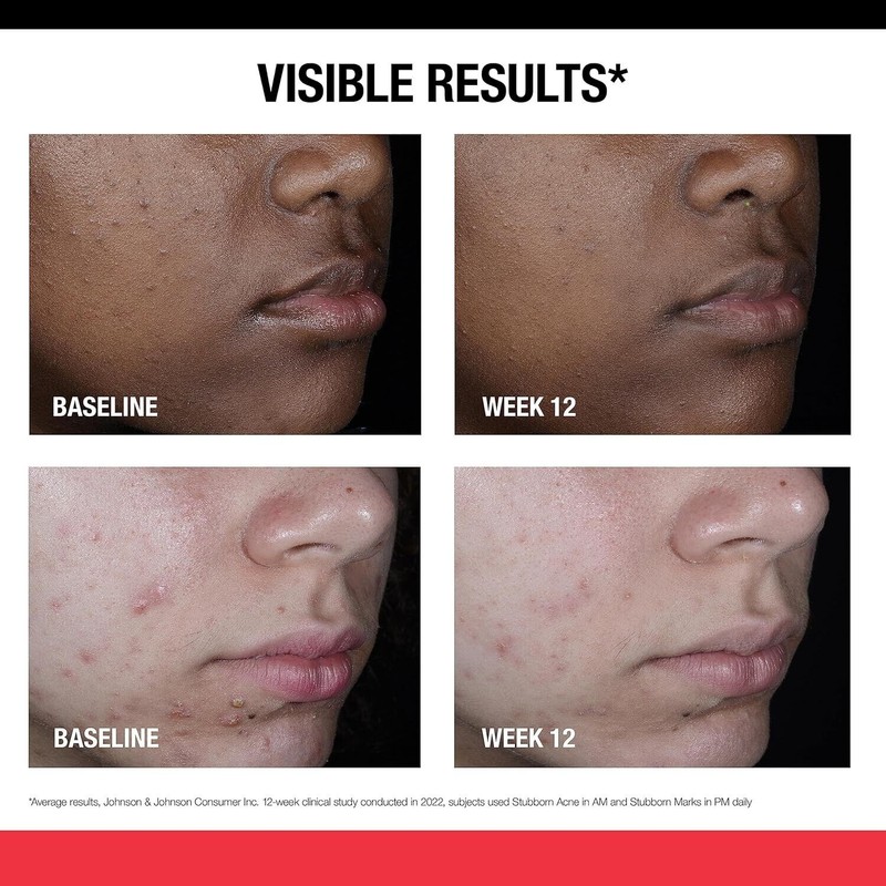 Neutrogena Retinol PM Treatment for Stubborn Marks - 29 ml