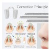 Kit Férula Doyle Nasales Médica Termoplásticas Rinoplastia Transparente