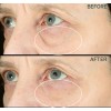 Strivectin Anti Wrinkle Sd Advanced Crema De Rostro Y Ojos