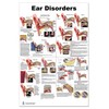Blue Tree Publishing Ear Disorders Poster 24x36inch, Otitis and Other