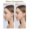 Yotlein Lymphatic Face Brush, Relieves Fatigue, Chin and Jawline Sculpting,