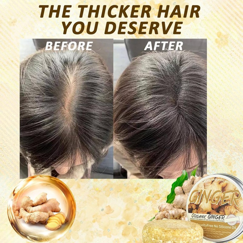 Champú Con Jengibre Para El Crecimiento Del Cabello, Champú Orgánico