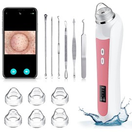 Blackhead Remover Vacuum, USB Interface Type Pore Vacuum, Black Head Extractions Tool with Camerafor, Men and Women Pore Cleaner, 3 Adjustment Modes & 6 Suction Heads(Light Pink)