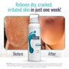 FOOTLOGIX DD Cream Mousse, blanco, 4.23 onzas