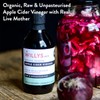Willy's Organic ACV Apple Cider Vinegar with Mother - Probiotocs
