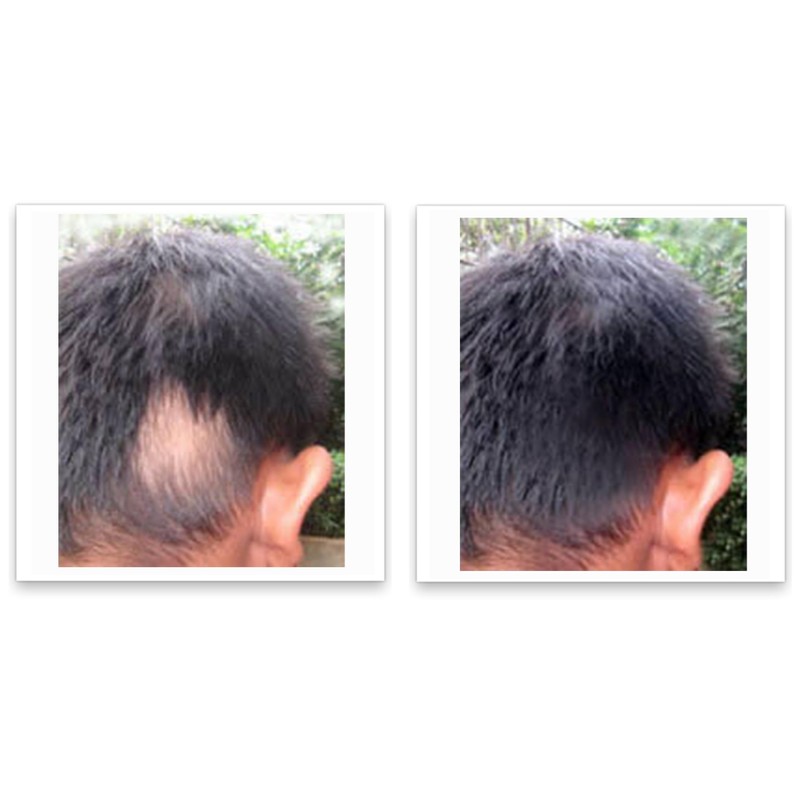 Caboki 10X Hair Powder Trial Size, Silver White