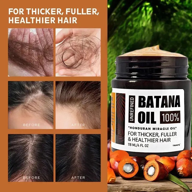 Aceite Capilar Batana, Nutre Y Da Volumen Al Cabello