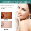 Crema Iluminadora Facial Paño Eelhoe Manchas Melasma Manchas