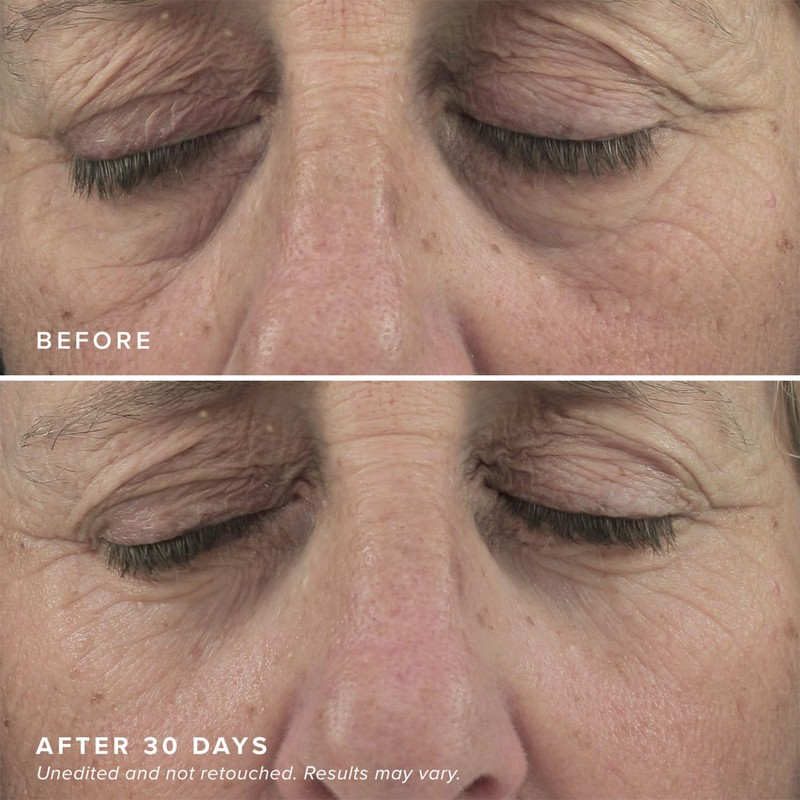 DRMTLGY Brightening Eye Masks (30 Pairs) - Caffeine Eye Masks