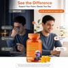 Eye Vitamin Gummies for Vision Support – Lutein Multivitamin Supplement