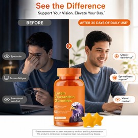 Eye Vitamin Gummies for Vision Support – Lutein Multivitamin Supplement for Men & Women’s Daily Routine