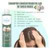 Shampoo Adiós Caspa + Ajo/ Seborrea Resequedad Cabello Graso