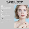 Milia Removal Cream - Gentle Spot Treatment for Face &