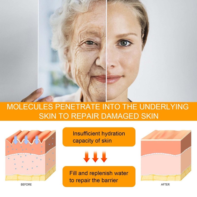 5D Peptide Anti-Ageing Eye Repair Cream, 15ml, Reduces Wrinkles, Fine