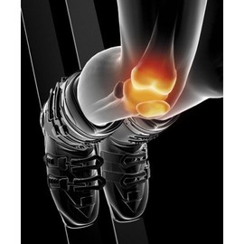 Epitact Sport-Kniebandage „Epithelium Flex 03“ XL Schwarz