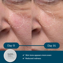 ELEMIS Dynamic Resurfacing Facial Pads 14pk, Trial Size Textured Exfoliating Pads for Radiant Complexion