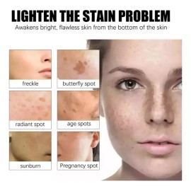 Crema Betarretin Manchas