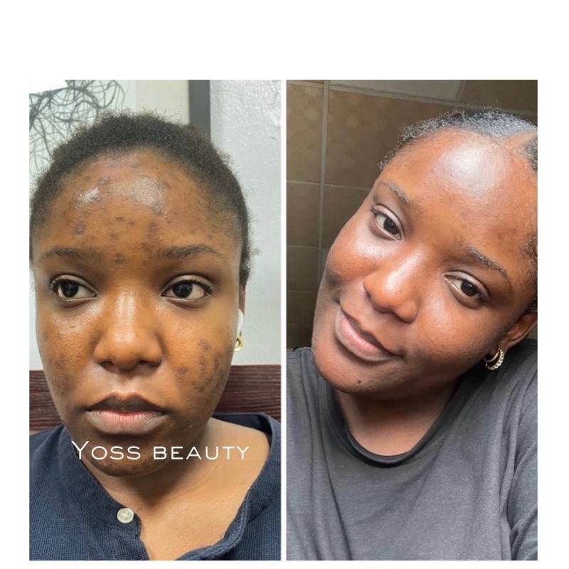 Turmeric Serum, Dark Spot Remover, Flawless Face Serum, Even Glowing