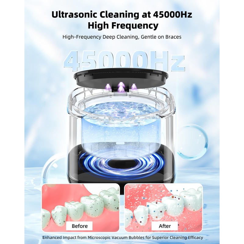 Ultrasonic Retainer Cleaning Device, NaNaLazy Dental Ultrasonic Cleaner for Retainers,