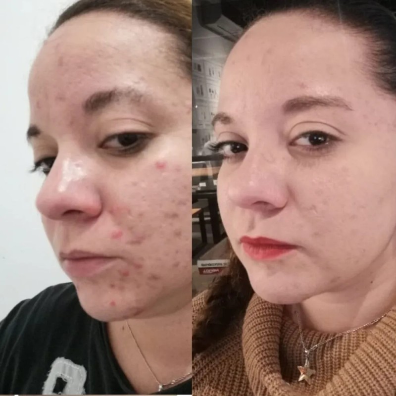 Crema De Thanaka. Elimina Manchas. Presentación 6 Sobres