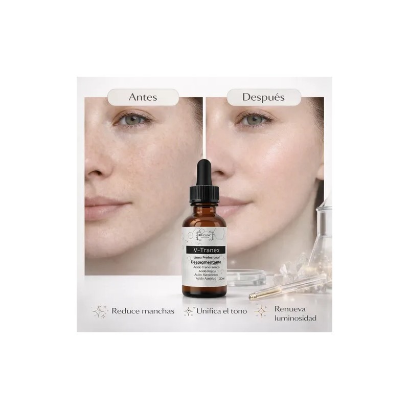 Serum V-tranex Despigmentante Acido Tranexamico Mancha 30ml