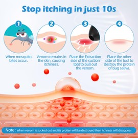 Insect Bite Relief Pen – Chemical-Free Heat Therapy for Mosquito Bites & Bee Stings | Portable, Kids-Safe & Reusable | Instant Itch & Swelling Relief | Bite Away