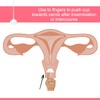 Cervix Sperm Cup,Transparent Color