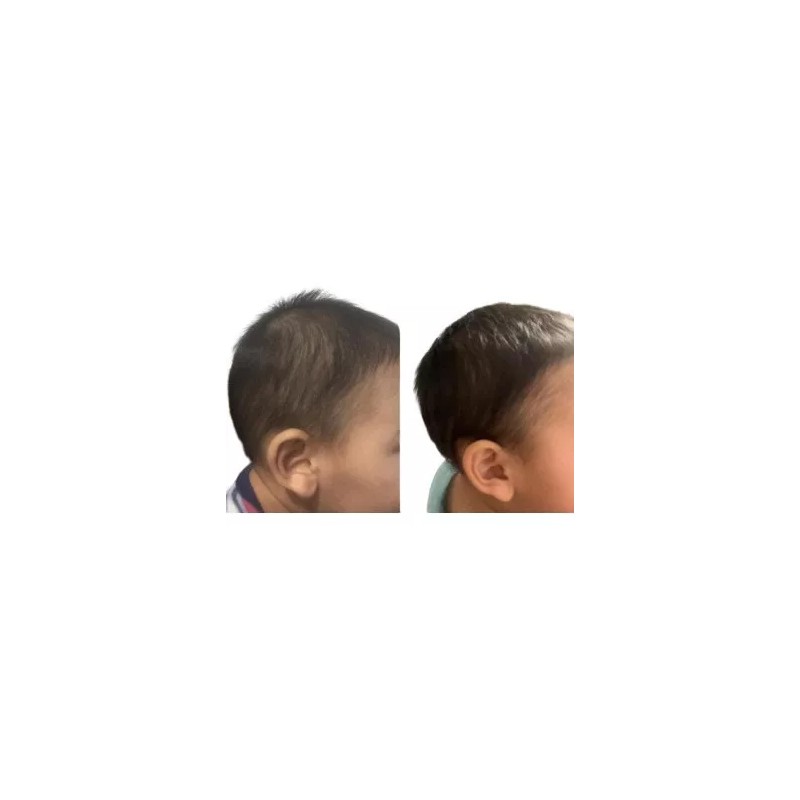 Nutrekcln Crema Acondicionadora Con Nutrientes Para Mejora De Vello