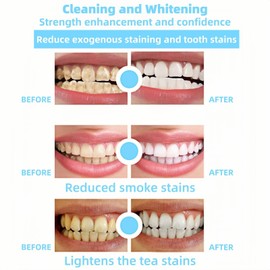 2PCS Hydroxy-Apatite Toothpaste,Fluoride-Free,Natural Ingredients,Whitening,and Sen-sitive Teeth Care,Whitening Toothpaste,Enamel Repair Toothpa-ste,Hydroxy-Apatite Tooth-Paste 7.5,Repair Tooth-Paste