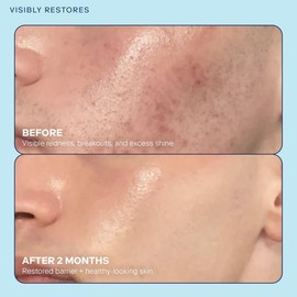 Skinfix Barrier+ Skin Barrier Restoring Gel Cream Mini – 0.5 oz – Crema facial hidratante para piel seca – Fortalece, visiblemente rellena y reafirma 