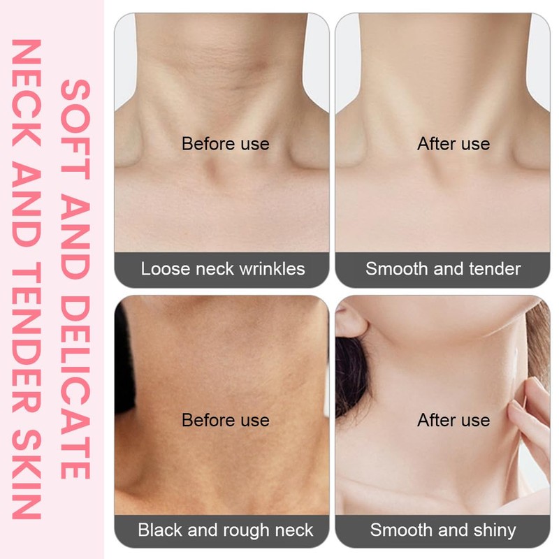 SexxLady Anti-Falten-Nackenpolster, Nackenmaske, wiederverwendbar feuchtigkeitsspendend Gel-Nacken-Patch, Glätten Sie Ihre Haut,