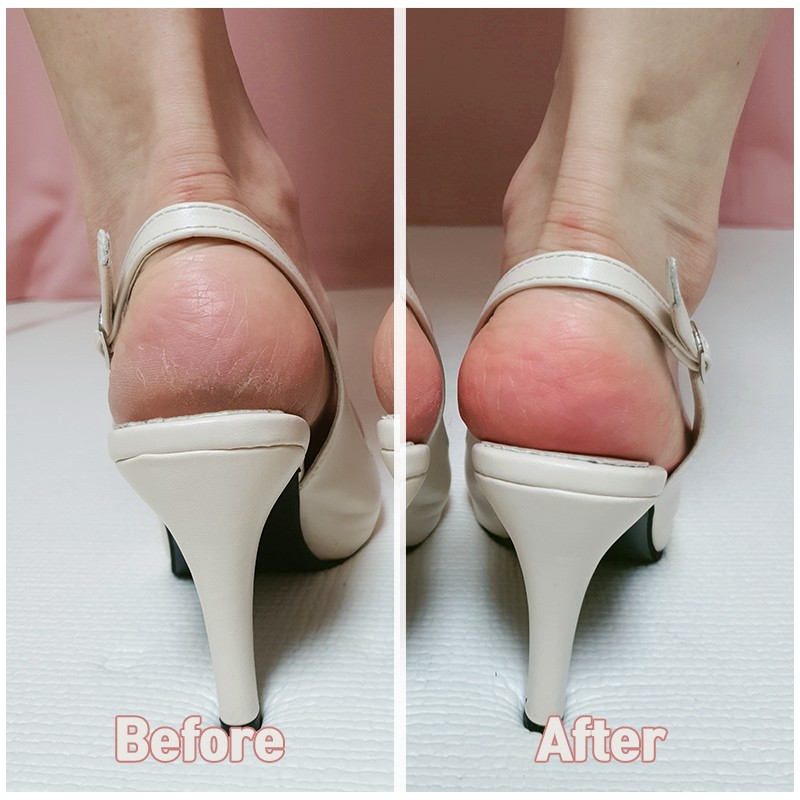 Mad for Cos Silky Coconut Oil Foot Mask 10 sheets