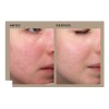Serum Salmon Dna Con Peptidos