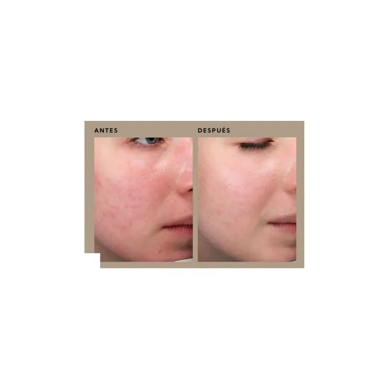 Serum Salmon Dna Con Peptidos